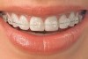 Anaheim Braces & Orthodontics